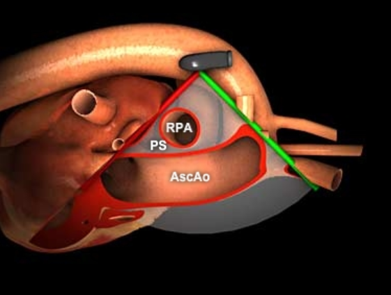Scanning School - TEE Basics: The Controls and the Views — Taming